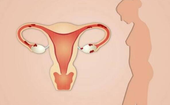 输卵管堵塞并发症都有哪些?